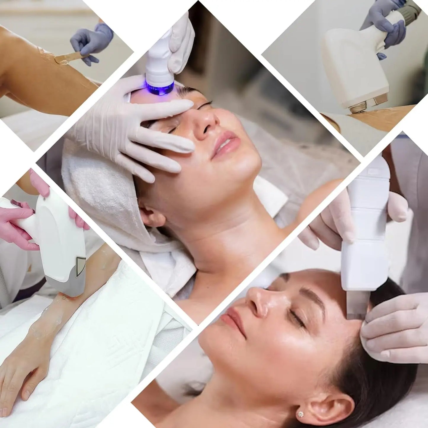 Gel refrescante para depilación láser IPL, gel ultrasónico, ácido hialurónico, hidratante, EMS RF, 3 o 9 unidades.