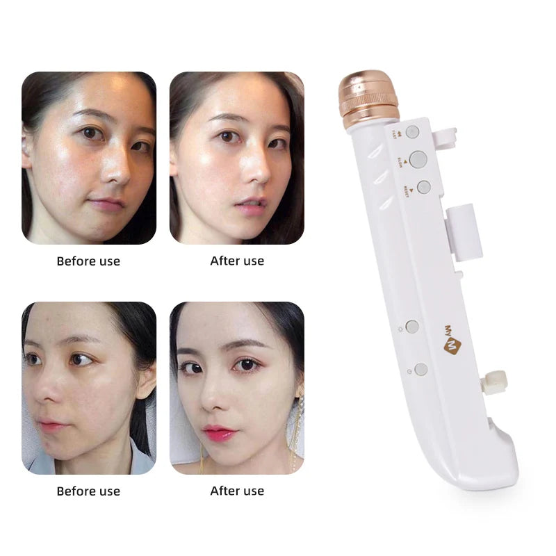 2th Handheld Meso Gun Injector nami Water Injection Derma Pen For Facial Skin Rejuvenation Anti Aging Mesotherapy Remove Wrinkle
